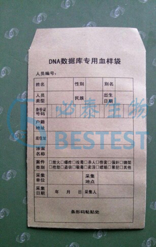 可定制 血样采集卡 HIV病毒基因检测卡 DNA采血卡 单环