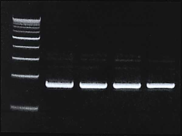 美国MOBIO质粒DNA大量提取试剂盒UltraClean&reg; Maxi Plasmid Prep Kit